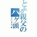 とある親父のハゲ頭（ヤバイやんー笑）