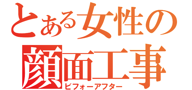 とある女性の顔面工事（ビフォーアフター）