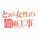 とある女性の顔面工事（ビフォーアフター）