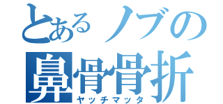 とあるノブの鼻骨骨折（ヤッチマッタ）