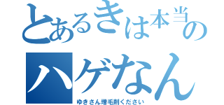 とあるきは本当のハゲなんです（ゆきさん増毛剤ください）