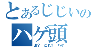 とあるじじいのハゲ頭（あ？　これ？　ハゲ）