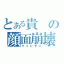 とある貴の顔面崩壊（クソレモン）