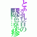 とある乳首の赤色発疹（猫アレルギー）