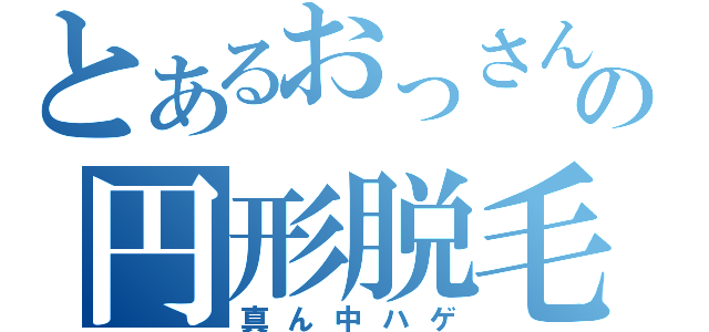 とあるおっさんの円形脱毛症（真ん中ハゲ）