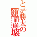 とある勝太の顔面崩壊（ヒドイカオ）