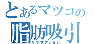 とあるマツコの脂肪吸引（リポサクション）