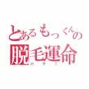 とあるもっくんの脱毛運命（ハゲ！）