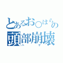 とあるお○はらの頭部崩壊（ハゲ）