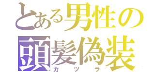 とある男性の頭髪偽装（カ　ツ　ラ）