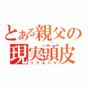 とある親父の現実頭皮（リアルハゲ）