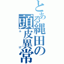 とある縄田の頭皮異常（ふけ）