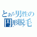 とある男性の円形脱毛（ハゲ）