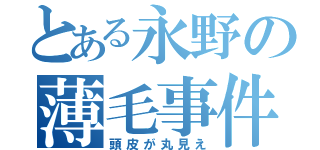 とある永野の薄毛事件（頭皮が丸見え）