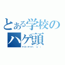 とある学校のハゲ頭（テストオワタ（＾ｑ＾））