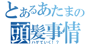 とあるあたまの頭髪事情（ハゲていく！？）