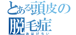 とある頭皮の脱毛症（おはげちい）