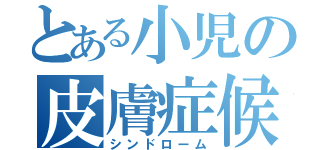 とある小児の皮膚症候群（シンドローム）