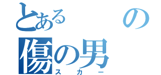 とあるの傷の男（スカー）