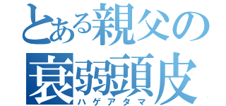 とある親父の衰弱頭皮（ハゲアタマ）