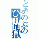 とあるのぶのひげ地獄Ⅱ（もじゃもじゃ～）