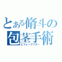 とある脩斗の包茎手術（ビフォーアフター）