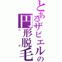 とあるザビエルの円形脱毛症（ハゲ）