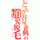 とある谷屋義典の頭髪脱毛（ハゲ）