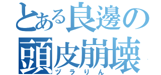 とある良邊の頭皮崩壊（ヅラりん）