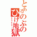 とあるのぶのひげ地獄（もじゃもじゃ～）