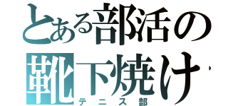 とある部活の靴下焼け（テニス部）