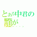 とある中君の頭が（パーーン）