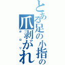 とある足の小指の爪剥がれた（ポロリ）