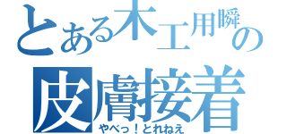 とある木工用瞬間接着剤の皮膚接着事故（やべっ！とれねえ）