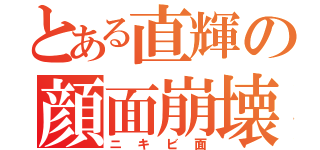 とある直輝の顔面崩壊（ニキビ面）