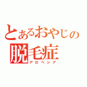 とあるおやじの脱毛症（アロペシア）