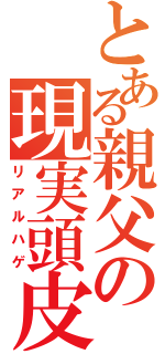 とある親父の現実頭皮（リアルハゲ）