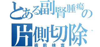 とある副腎腫瘍の片側切除（術前検査）