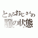 とあるおじさんの頭の状態（は　　　　　げ）