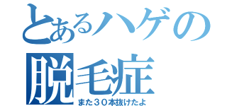 とあるハゲの脱毛症（また３０本抜けたよ）