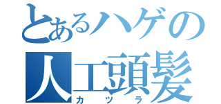 とあるハゲの人工頭髪（カツラ）